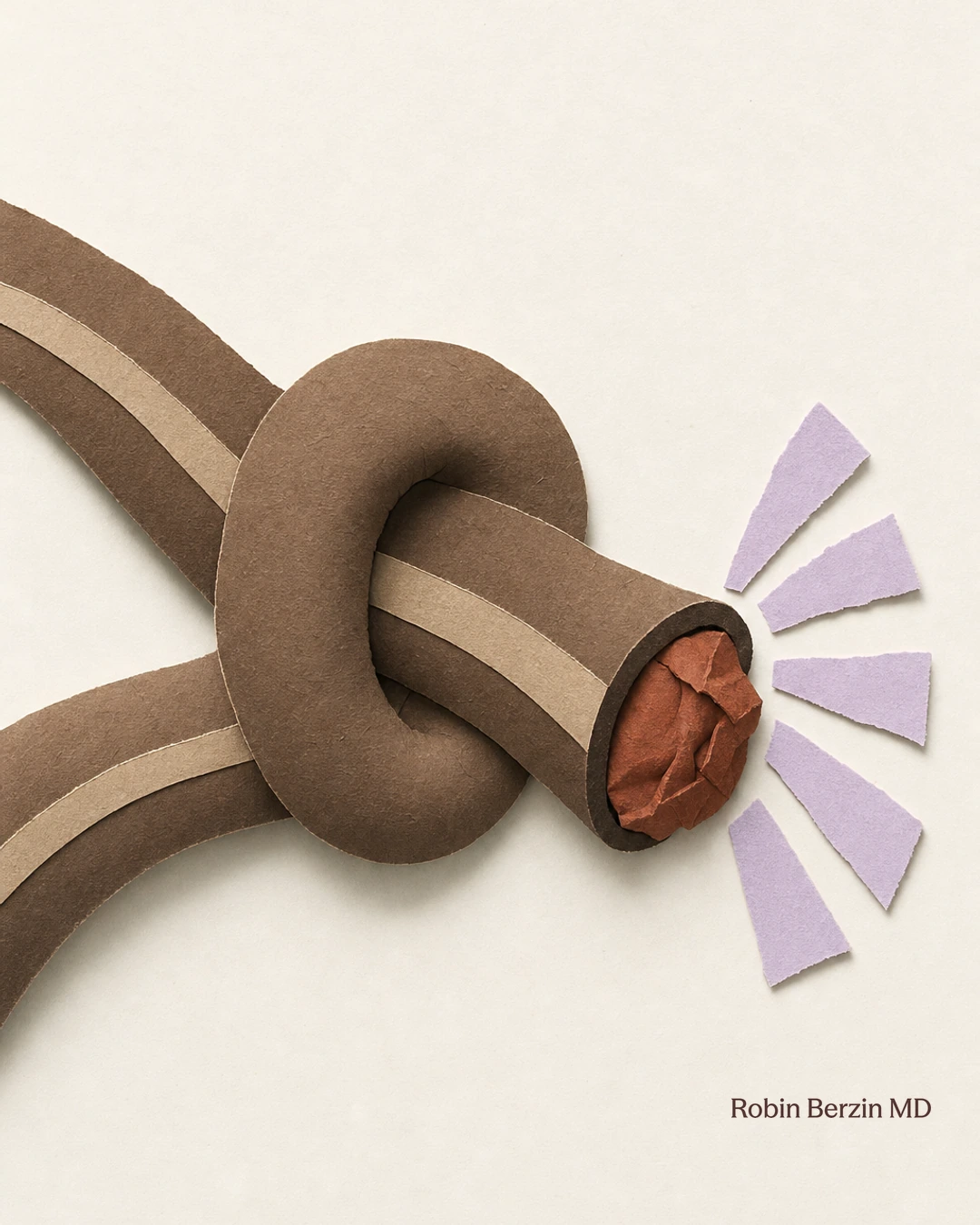A kinked garden hose building pressure behind the blockage as a metaphor for constipation and hemorrhoids.